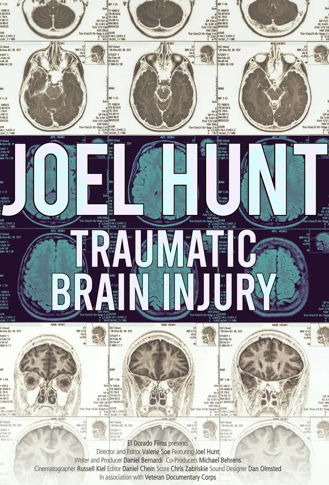 Joel Hunt: Traumatic Brain Injury (TBI)