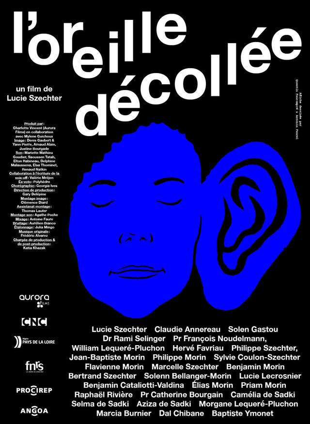 L'oreille décollée