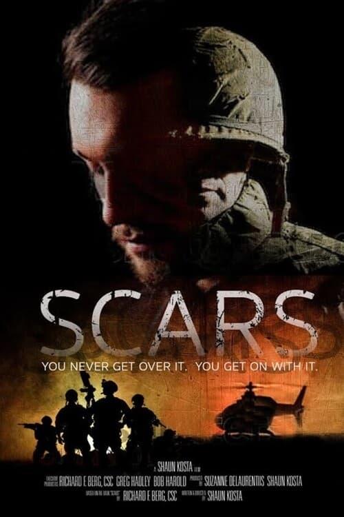 Scars